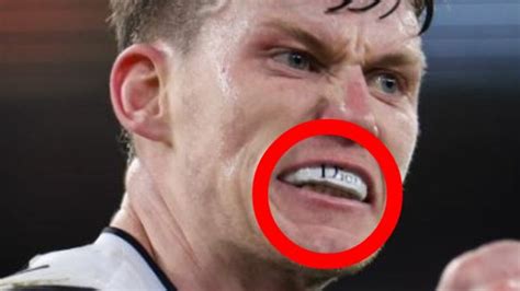 dior mouthguard|Carlton clarify viral detail in Sam Walsh’s mouthguard.